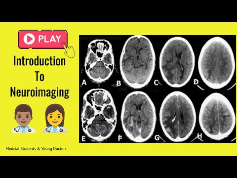  Brain Imaging, Crash Course ️