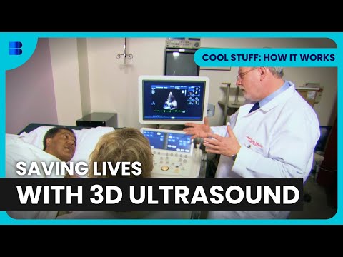 Life-Saving 3D Ultrasound Tech - Cool Stuff: How It Works - S01 EP05 - Science Documentary
