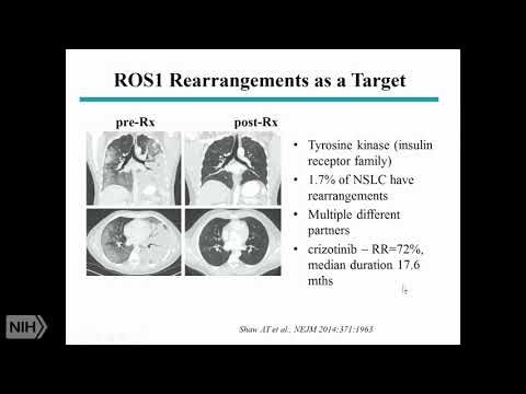 TRACO 2017: Non-SCLC and HSP90 chaperone