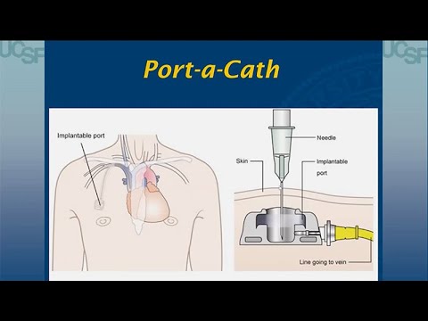 Tubes, Trachs, and Technology - Developmental Disabilities Update